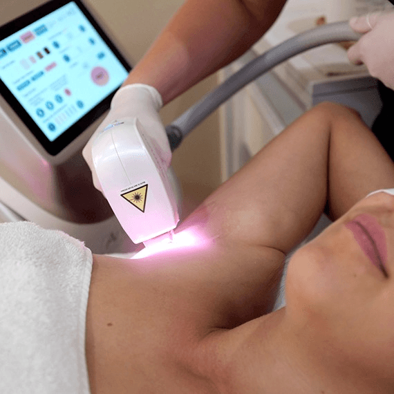 Épilation définitive au Laser Diode